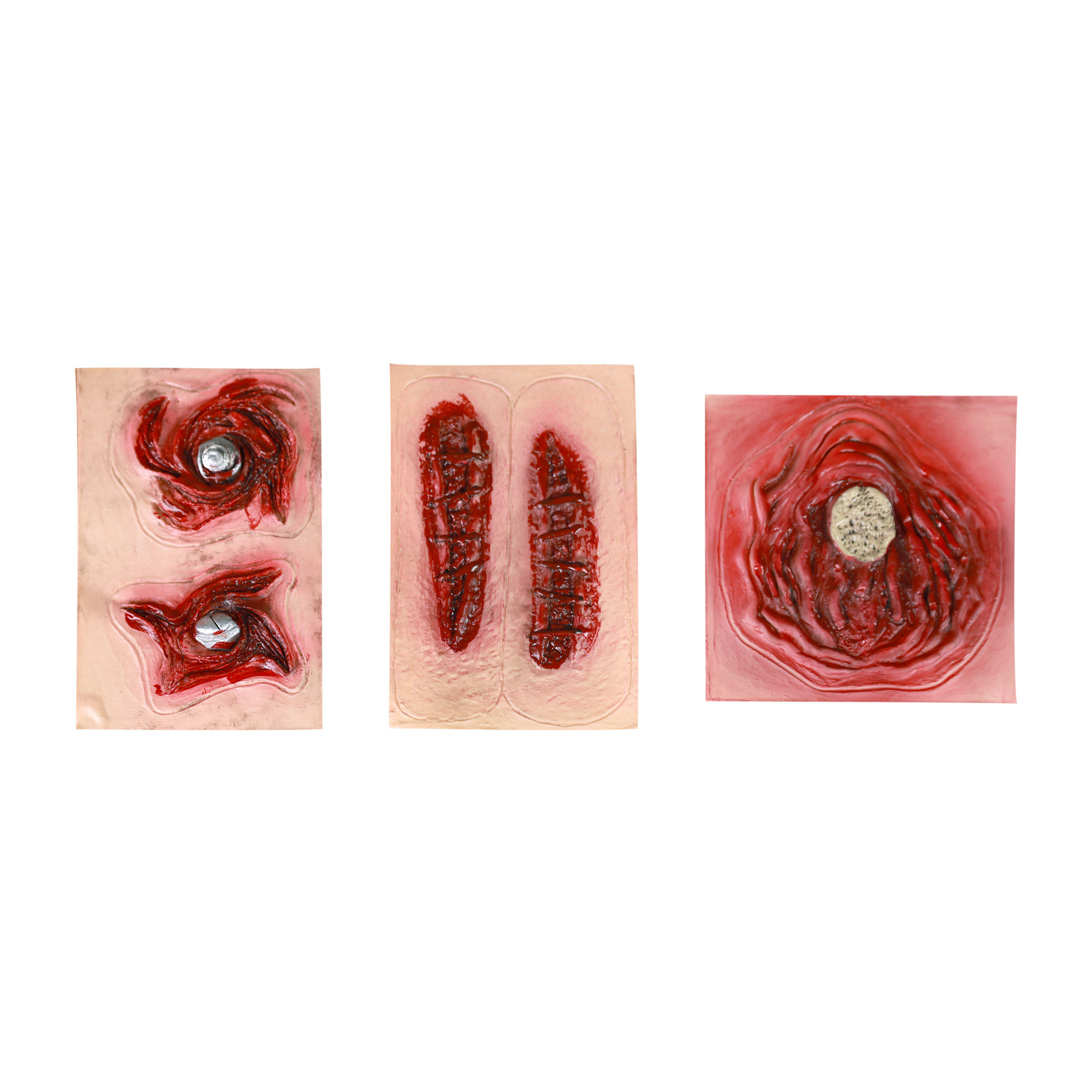 the self-adhesive scars, 3 types